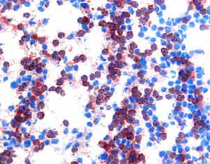 Células coloreadas de CD4 humanas en nodo de linfa 