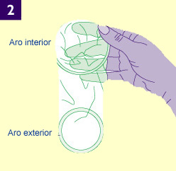 Un preservativo femenino extendido mostrando un aro interior y un aro el borde exterior